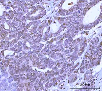 Anti-PRPF18 Antibody