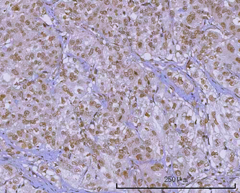 Anti-PRPF18 Antibody