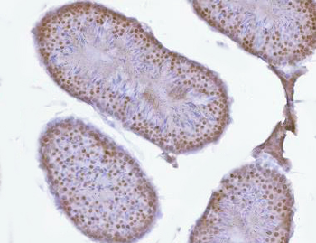 Anti-PRPF18 Antibody