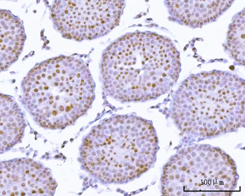 Anti-PRPF18 Antibody