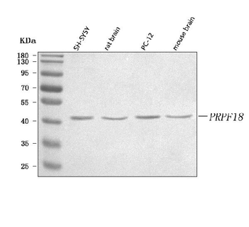 Anti-PRPF18 Antibody