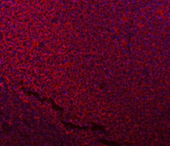 Anti-NDUFB7 Antibody