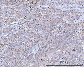 Anti-NDUFB7 Antibody