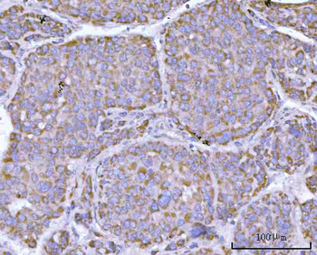 Anti-NDUFAF4 Antibody