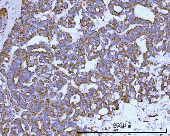 Anti-NDUFAF4 Antibody
