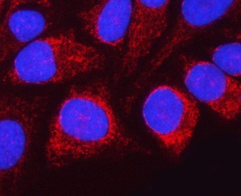 NDUFAF4 Antibody