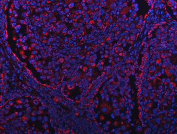 Anti-GRIM19/NDUFA13 Antibody