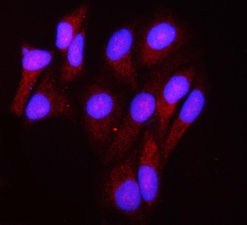 Anti-GRIM19/NDUFA13 Antibody