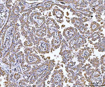 Anti-GRIM19/NDUFA13 Antibody