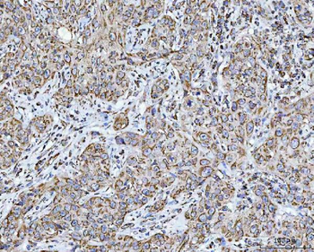 Anti-GRIM19/NDUFA13 Antibody