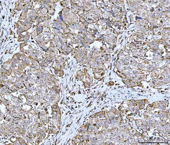 Anti-GRIM19/NDUFA13 Antibody