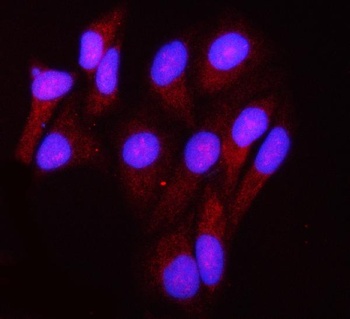 GRIM19/NDUFA13 Antibody