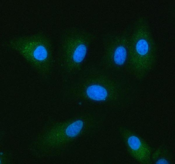 Anti-C5orf33/NADK2 Antibody