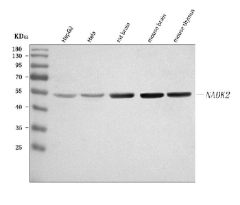 Anti-C5orf33/NADK2 Antibody