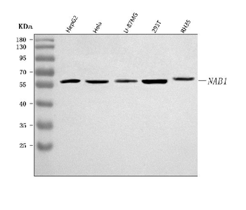 Anti-NAB1 Antibody