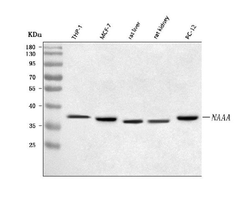 Anti-NAAA Antibody
