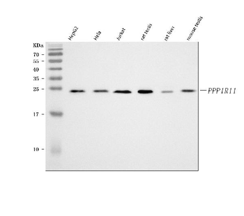 Anti-PPP1R11 Antibody