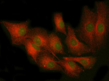 PRKCE Rabbit Polyclonal Antibody