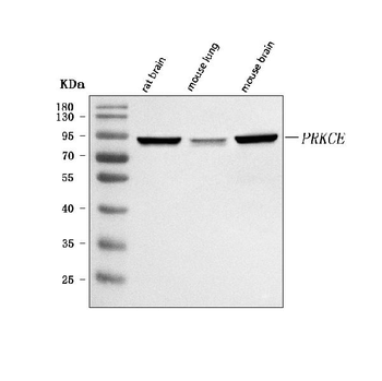 Anti-PRKCE Antibody