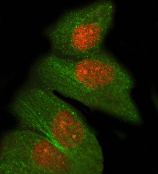 Anti-PRDM8 Antibody