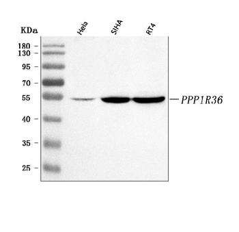 PPP1R36 Antibody