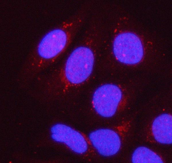 Anti-PPP1R15B Antibody