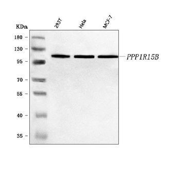 Anti-PPP1R15B Antibody