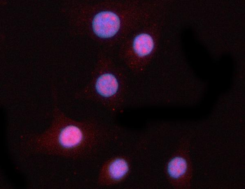 PPM1N Rabbit Polyclonal Antibody