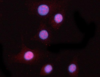 PPM1N Antibody