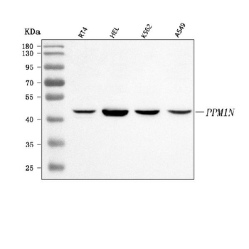 PPM1N Rabbit Polyclonal Antibody