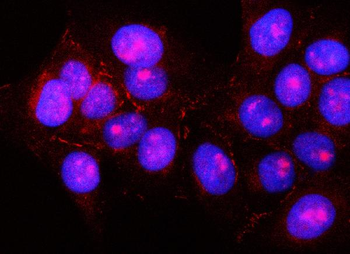 Anti-PNLIPRP2 Antibody
