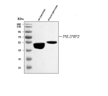 Anti-PNLIPRP2 Antibody