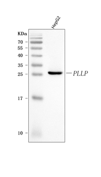 Anti-Plasmolipin/PLLP Antibody