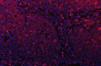 Anti-PLD6 Antibody