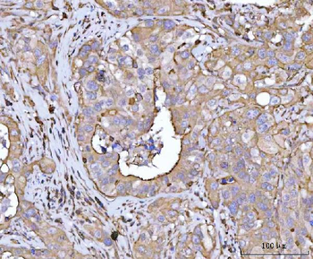Anti-PLD6 Antibody