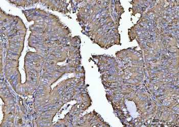 Anti-PLD6 Antibody