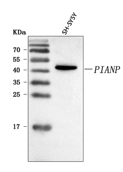 Anti-PIANP Antibody