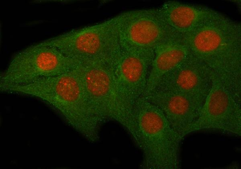 Anti-OVOL2 Antibody
