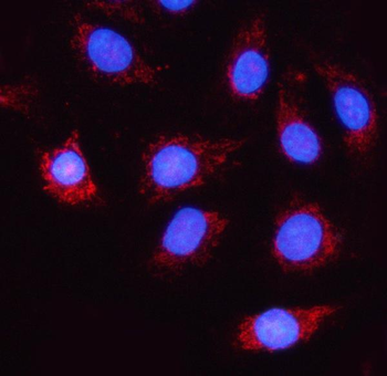 NDUFA5 Antibody