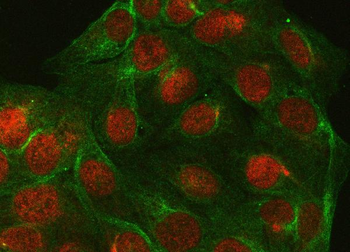 Anti-PPP4C Antibody