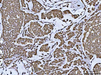 Anti-PPP4C Antibody