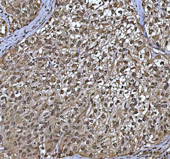 Anti-PPP4C Antibody