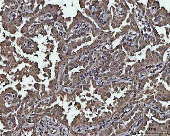 Anti-PPP4C Antibody