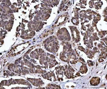 Anti-PPP4C Antibody