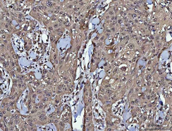 Anti-PPP4C Antibody