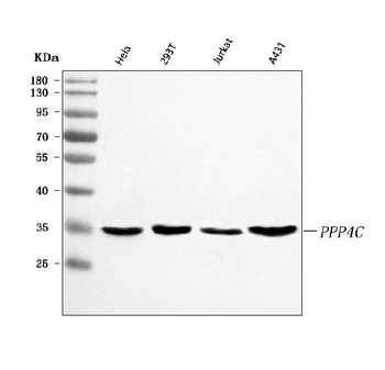 Anti-PPP4C Antibody