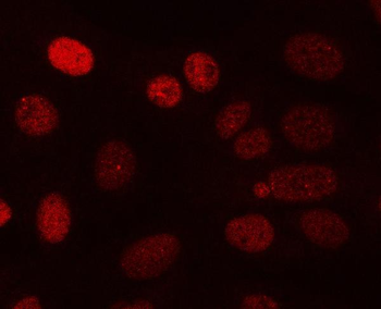 Anti-PPP3CA Antibody
