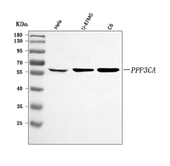 Anti-PPP3CA Antibody