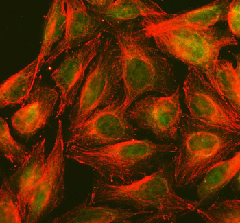 Anti-PPP2R5D Antibody