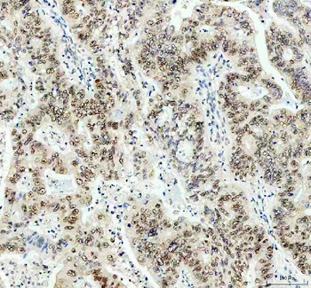 Anti-PPP2R5D Antibody